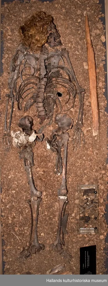 Syrorna i mossen hade bevarat kroppen så att den inte helt förmultnat. Skelettet fanns kvar och var väl bevarat. Förutom skelettet var håret intakt. Det gick att identifiera hudbitar och muskelstycken och i kroppens inre fanns till exempel hjärnan kvar. Ämnen i torvmossen hade gett håret en kopparröd färg och skelettet en brunaktig patina. Håret var 10–12 cm långt, en modelängd för män vid mitten av 1300-talet.

Bockstensmannens skelett har genom åren undersökts av flera experter, bland andra tandläkare Gunnar Johansson, osteolog Nils-Gustaf Gejvall, kirurg Claes Lauritzen och osteolog Torbjörn Ahlström. De har tillsammans funnit att Bockstensmannen var 171 cm lång, vilket kan mätas utifrån lårbenet. Han var högerhänt, för muskelfästena är större på höger sida. Det finns även tecken på lårbenet som tyder på att han ridit en del. Bockstensmannen var gracilt byggd och man kan se på de små muskelfästena att han inte var van vid hårt kroppsarbete. Dessutom hade han början till en sjukdom, ”DISH”, som bara har hittats bland skelett från de högre klasserna.

Kroppen var pålad enligt en utbredd folktro om att en ekpåle genom hjärtat skulle hindra den döde från att ”gå igen”, dvs bli en gengångare. Kraniet är deformerat, sammanpressat från båda sidorna, och detta har tolkats på olika sätt. Kirurgen Claes Lauritzen menar att skadorna på kraniets högra sida är ett resultat av våld riktat mot huvudet. Osteolog Torbjörn Ahlström hävdar att deformationen beror på att skallen var mjuk som läder och hade pressats ihop av mossens tyngd samt skadats av harven som drogs över skelettet vid fyndtillfället. Mossens mångåriga påverkan på skelettet hade gjort skallen mjuk och formbar.