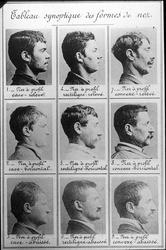 Hans Daae: Næseformer (Bertillon)