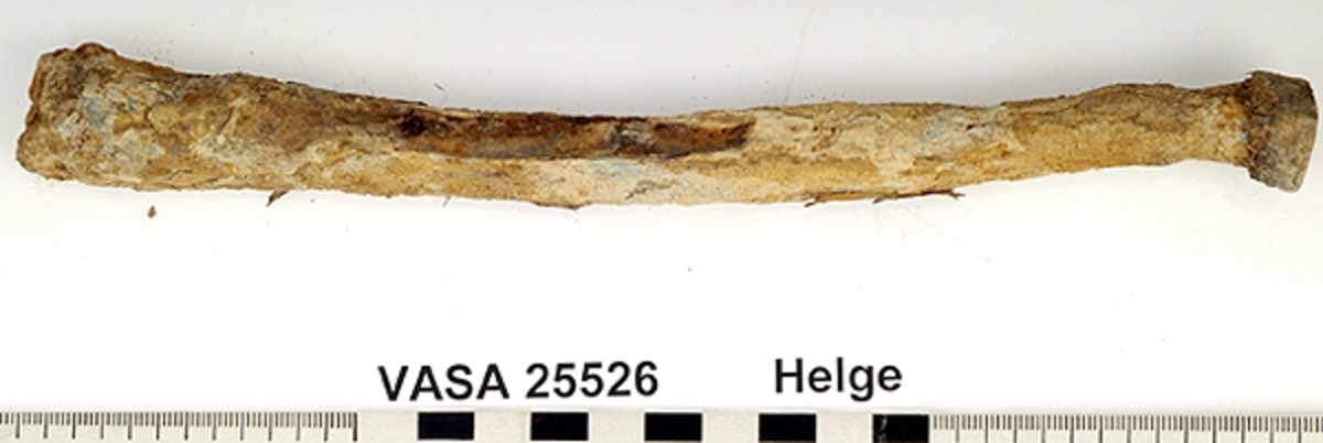 Strålben. höger. Flagigt och skört.
Radius, dexter.