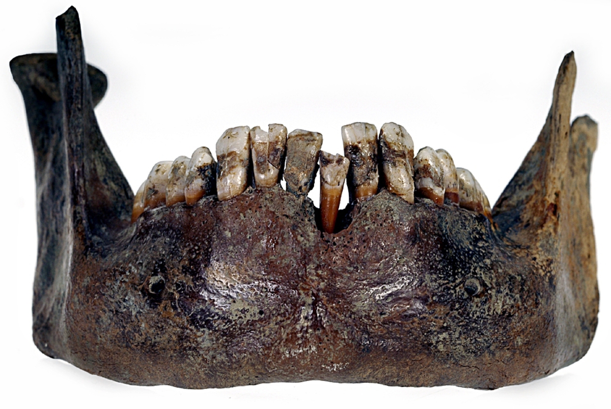 Underkäke med 14 tänder. I gott skick.
Mandibula.