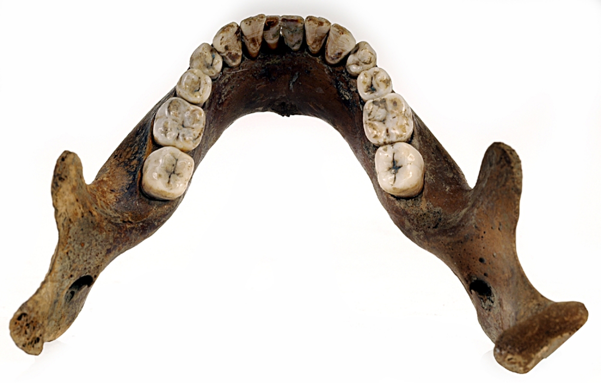 Underkäke med 14 tänder. I gott skick.
Mandibula.