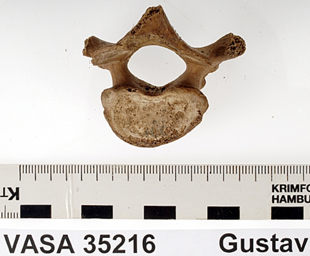 Bröstkota nr 2. I gott skick.
Vertebra Thoracicae no 2.