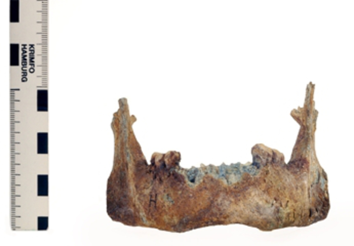 Underkäke med 9 tänder.
Mandibula.