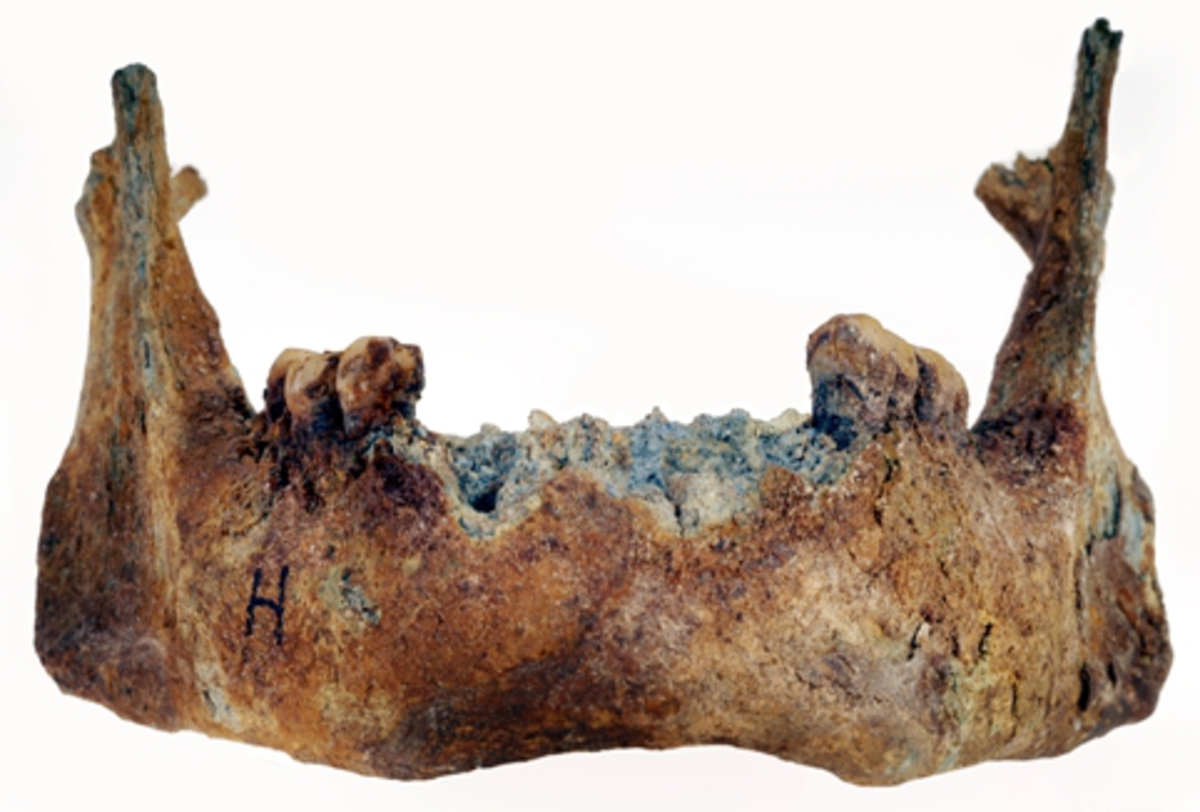 Underkäke med 9 tänder.
Mandibula.