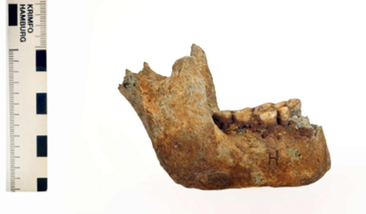 Underkäke med 9 tänder.
Mandibula.