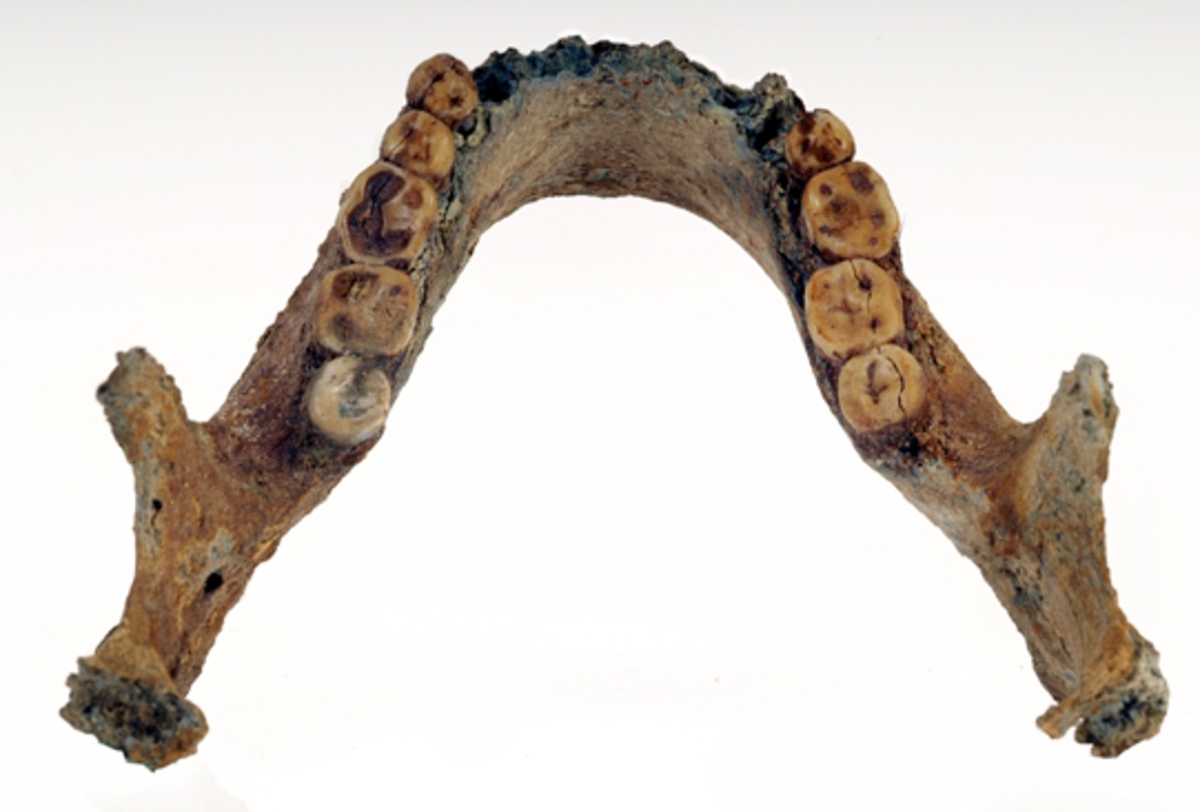 Underkäke med 9 tänder.
Mandibula.