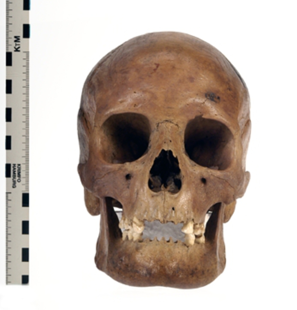 Kranium med 10 tänder.
Cranium.