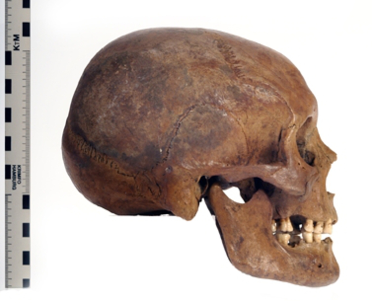 Kranium med 10 tänder.
Cranium.