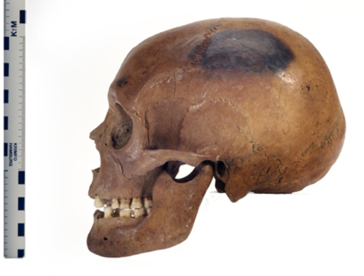 Kranium med 10 tänder.
Cranium.