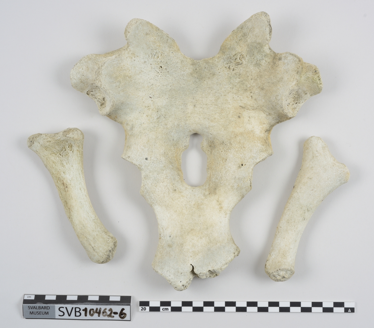 1 brystbein. 1 humerus. 2 skulderblad. 2 kragebein. 16 bein. 21 mellomskivevirvler.