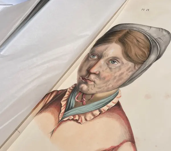 Oppdagelsen av leprabasillen