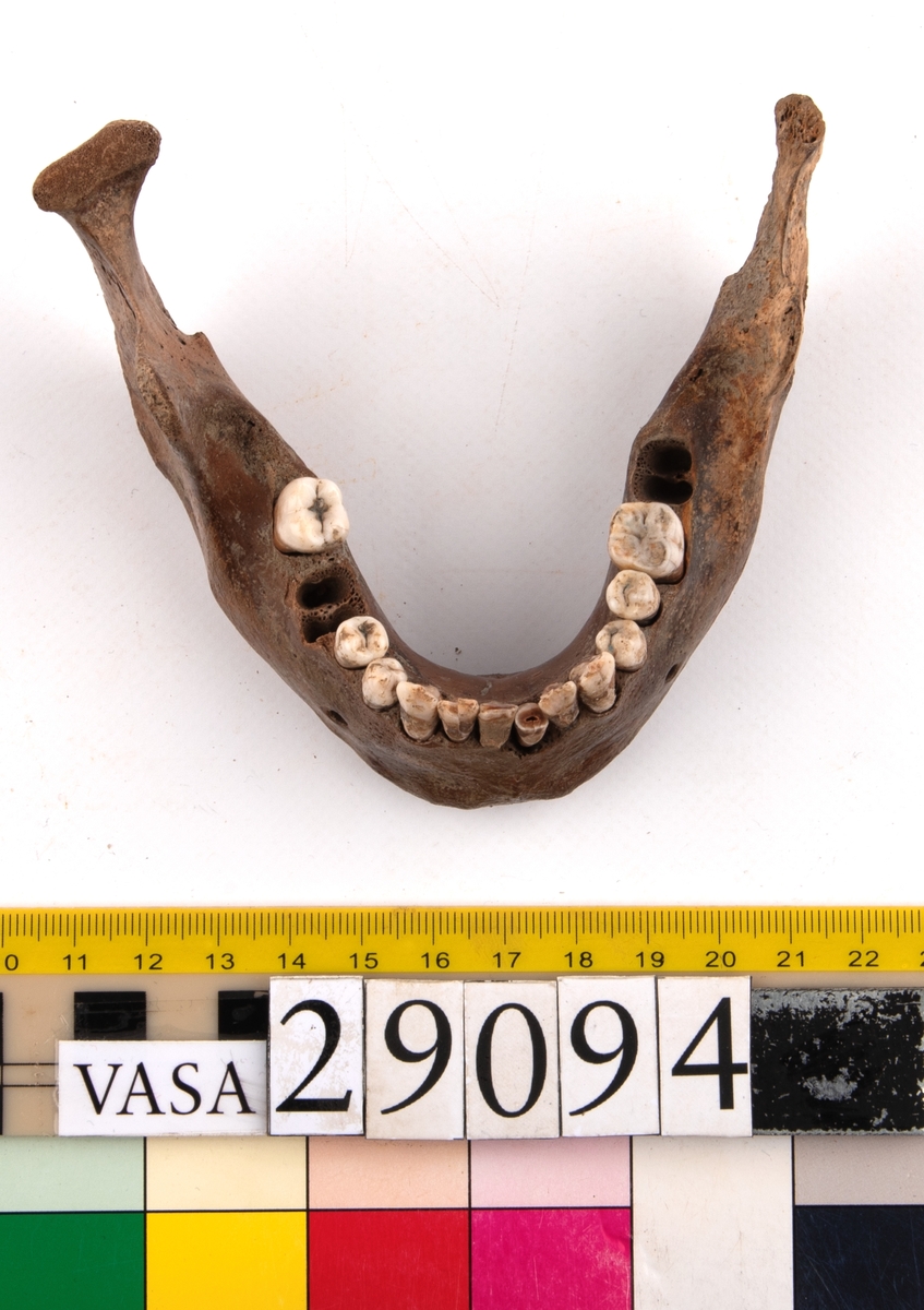 Underkäke med 14 tänder. I gott skick.
Mandibula.