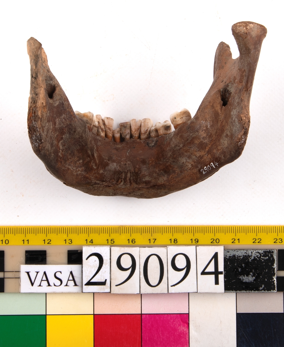 Underkäke med 14 tänder. I gott skick.
Mandibula.