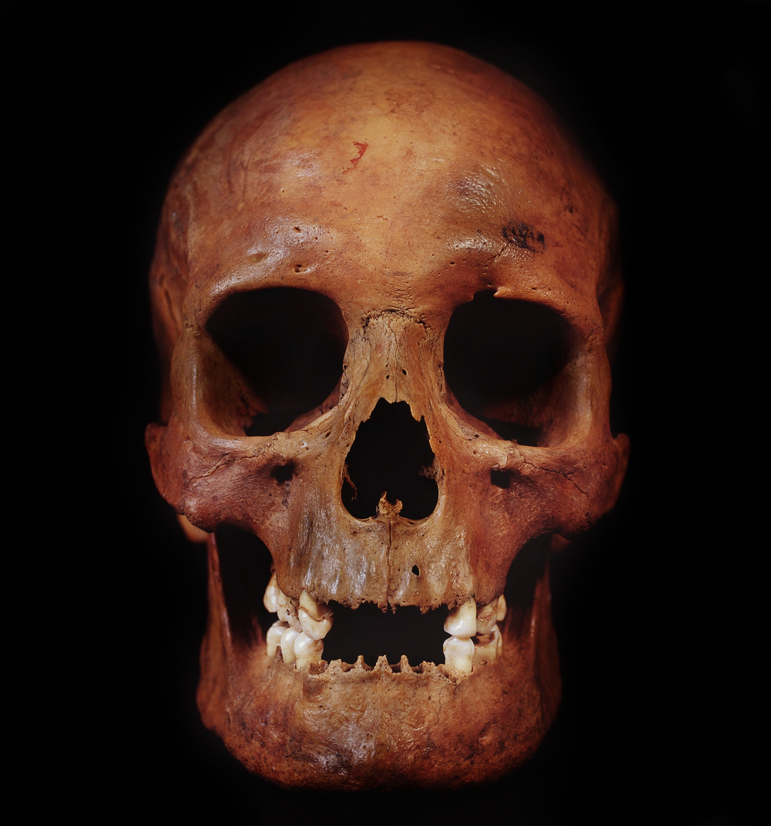 Kranium med 10 tänder.
Cranium.
