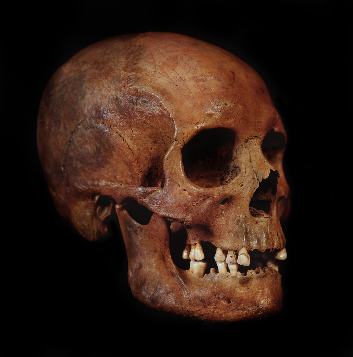 Kranium med 10 tänder.
Cranium.