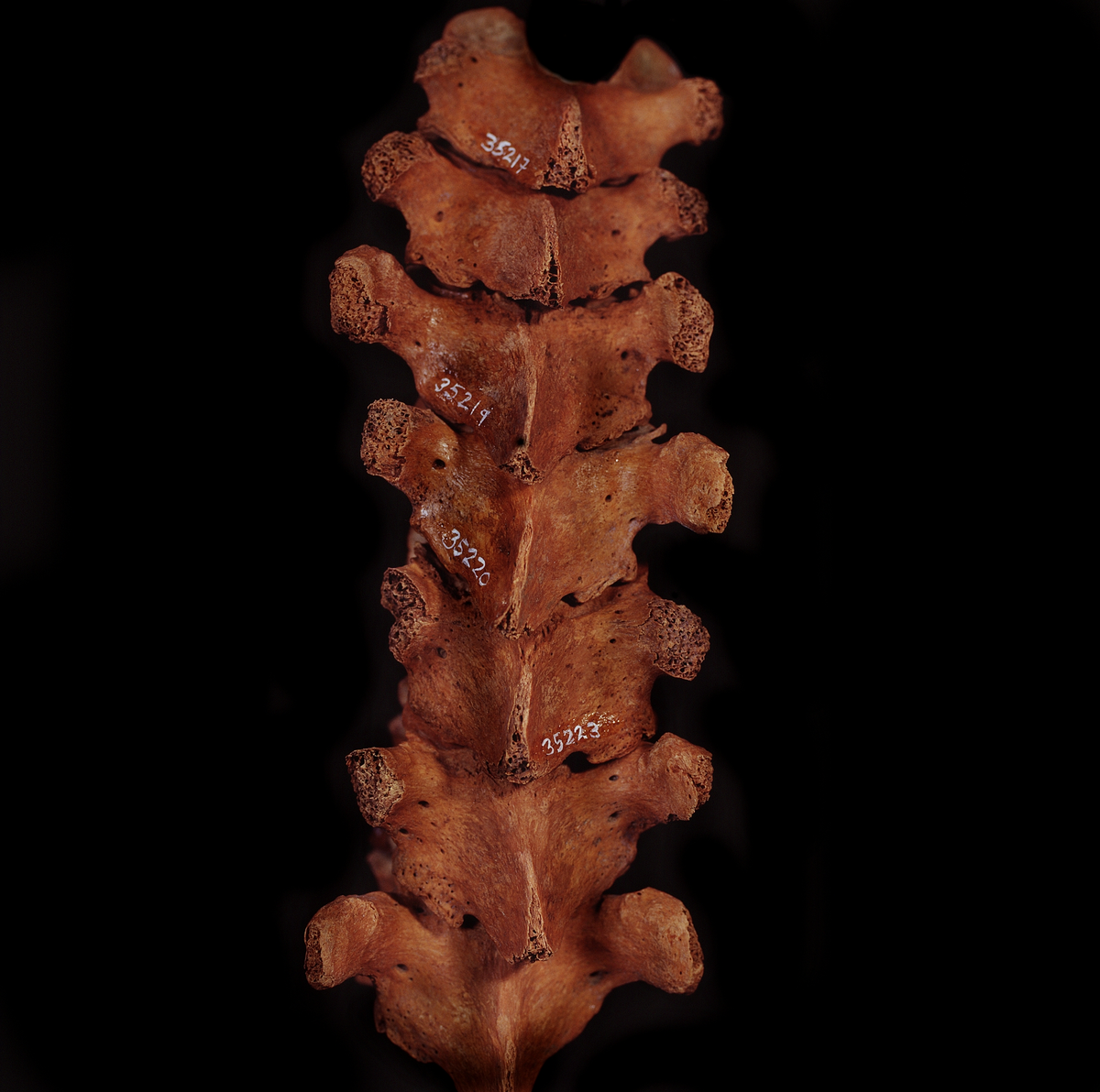 Bröstkota nr 2. I gott skick.
Vertebra Thoracicae no 2.