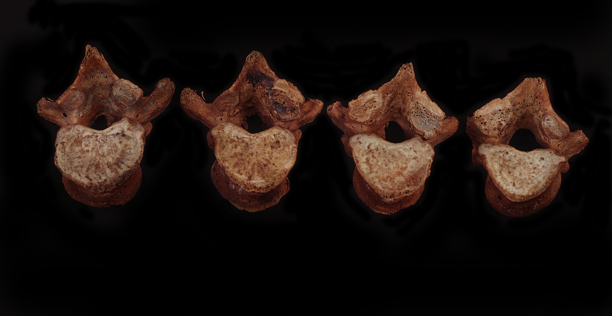 Bröstkota nr 5. I gott skick.
Vertebra Thoracicae no 5.