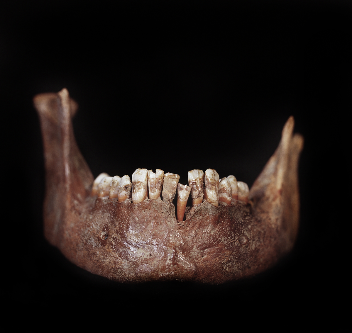 Underkäke med 14 tänder. I gott skick.
Mandibula.