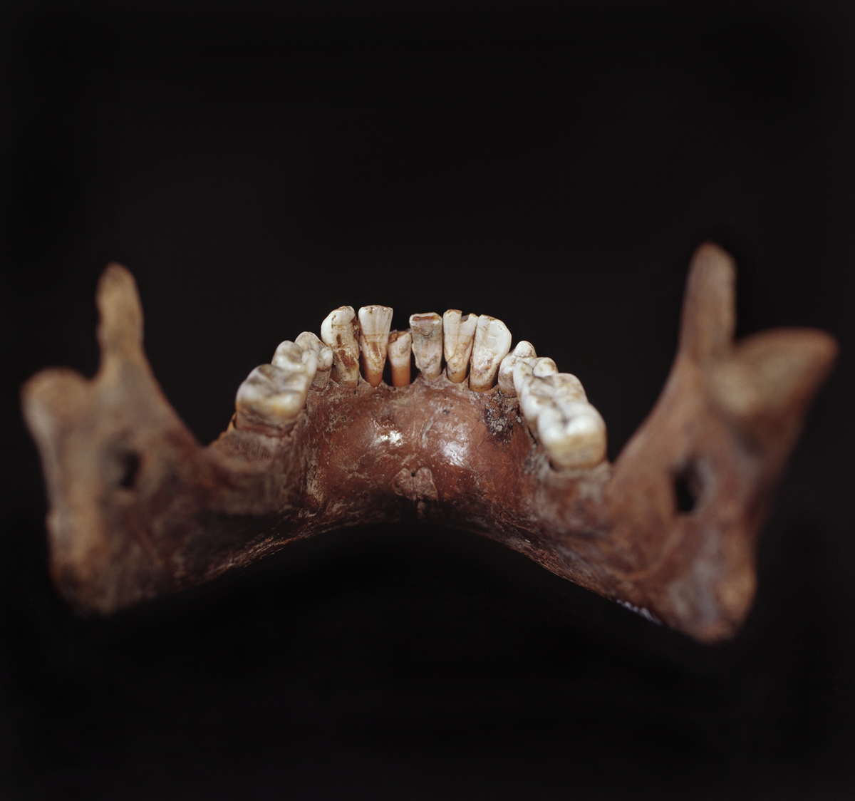 Underkäke med 14 tänder. I gott skick.
Mandibula.