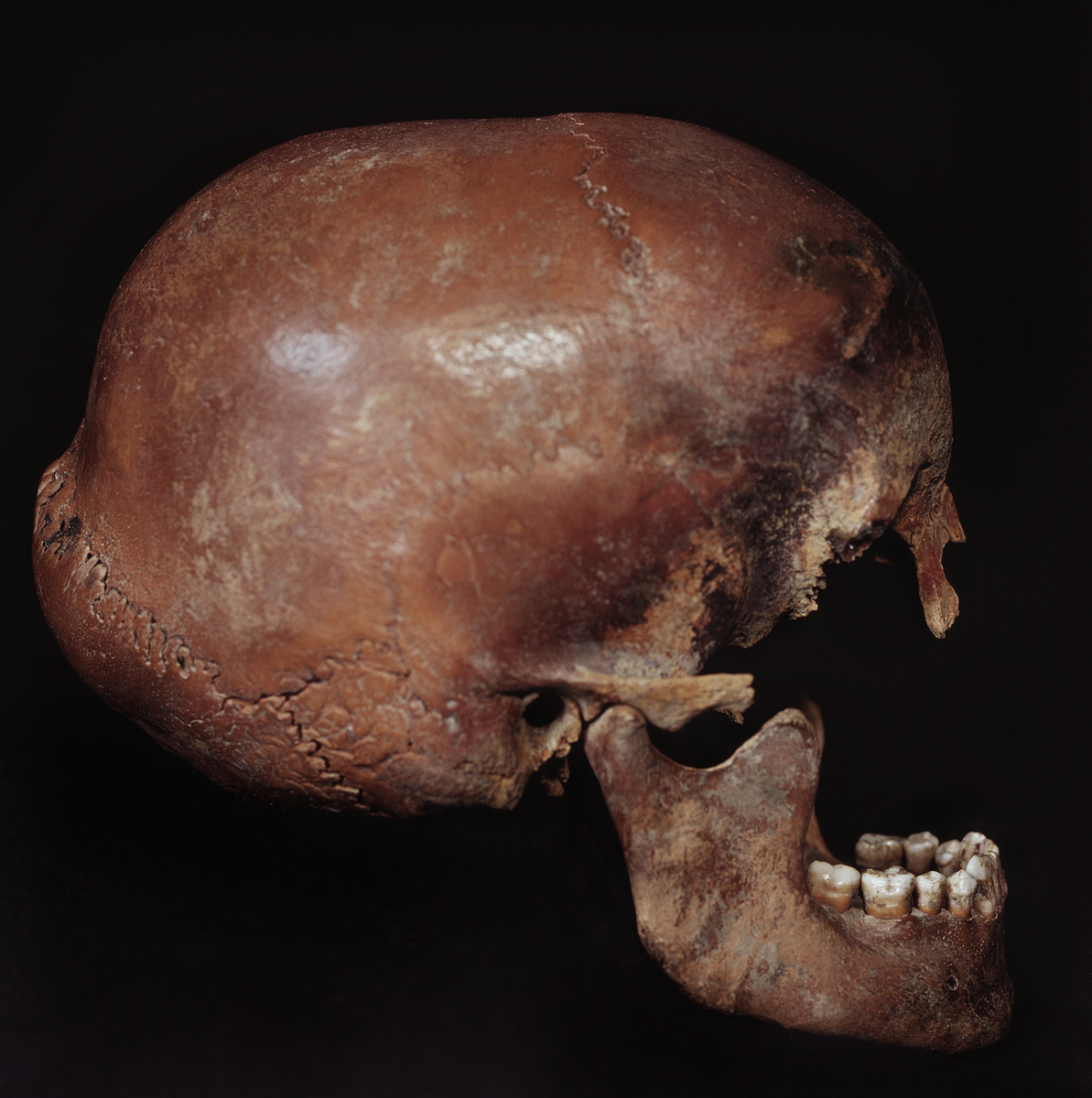 Underkäke med 14 tänder. I gott skick.
Mandibula.