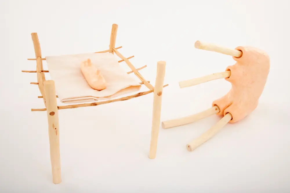 När du blev sjuk [Skulptur]