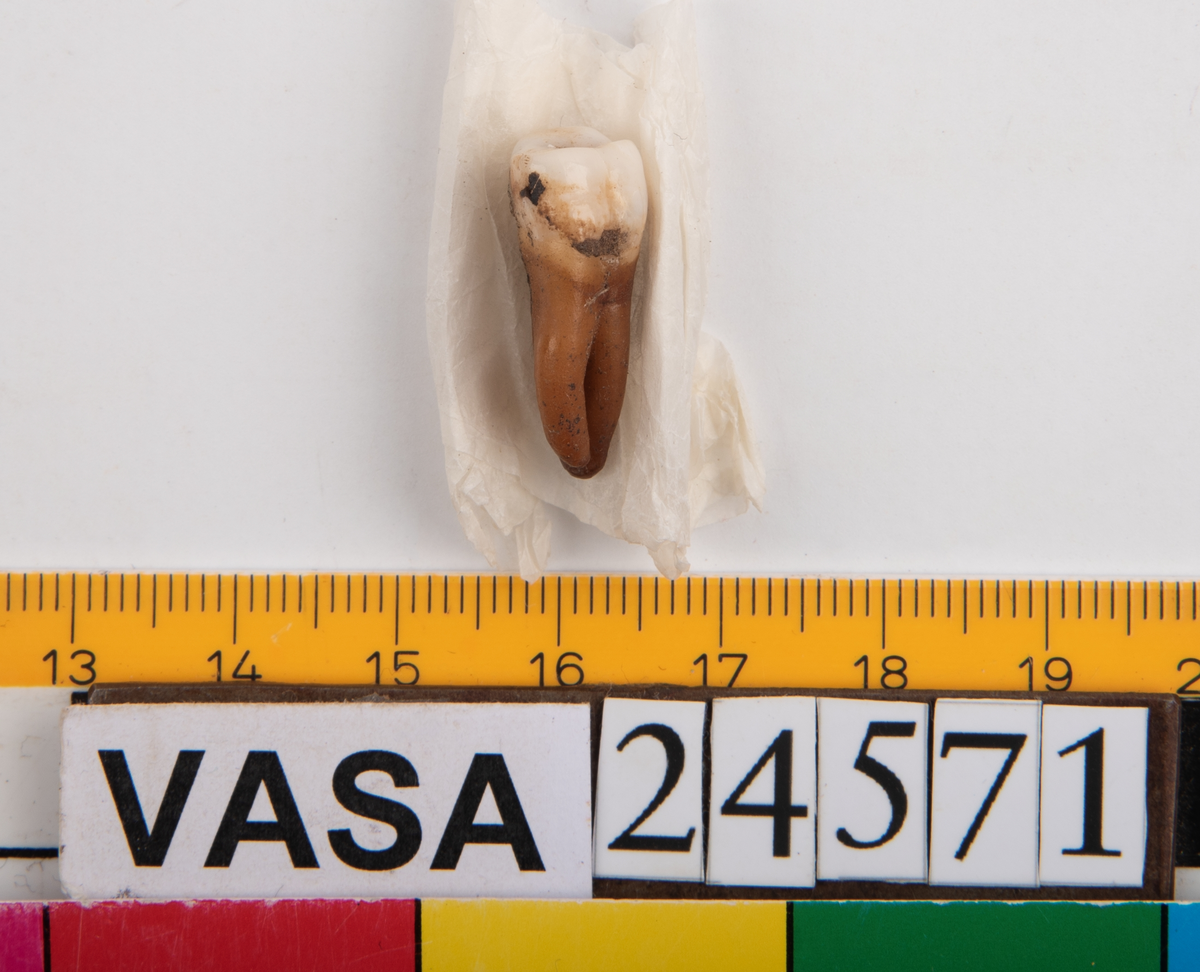 Andra molaren från höger sida i överkäken.
Molar 2 dexter, maxilla.