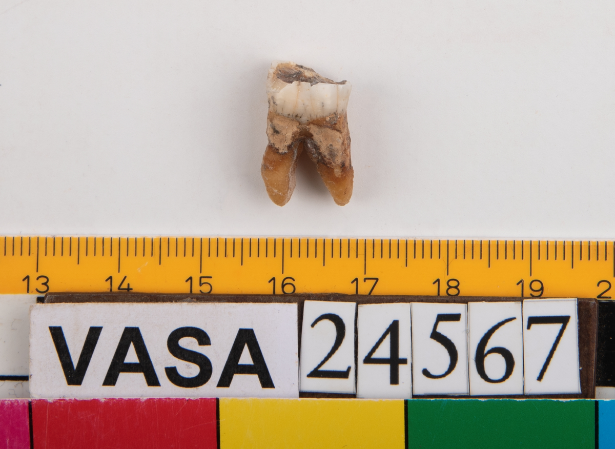 Första molaren från vänster sida i underkäken.
Molar 1 sinister, mandibula.