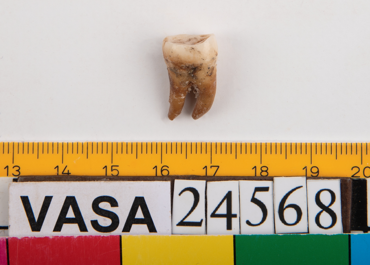 Tredje molaren från vänster sida i underkäken.
Molar 3 sinister, mandibula.