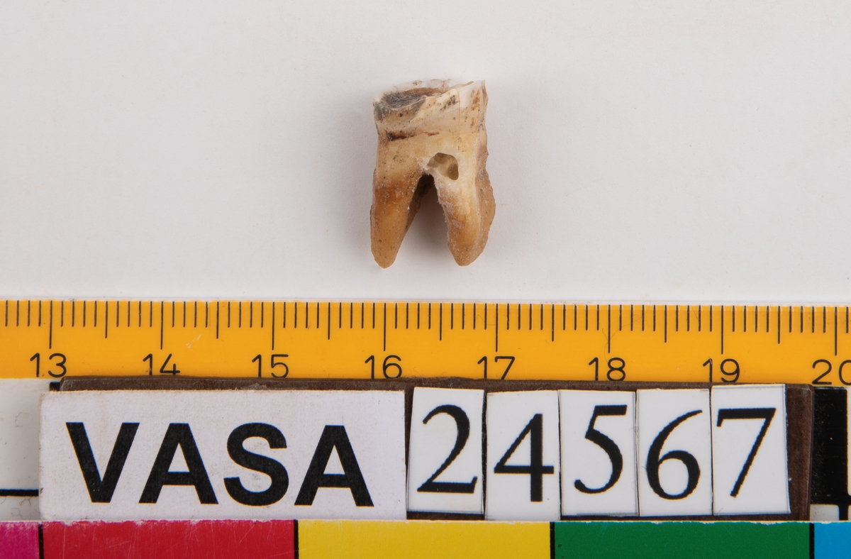 Första molaren från vänster sida i underkäken.
Molar 1 sinister, mandibula.