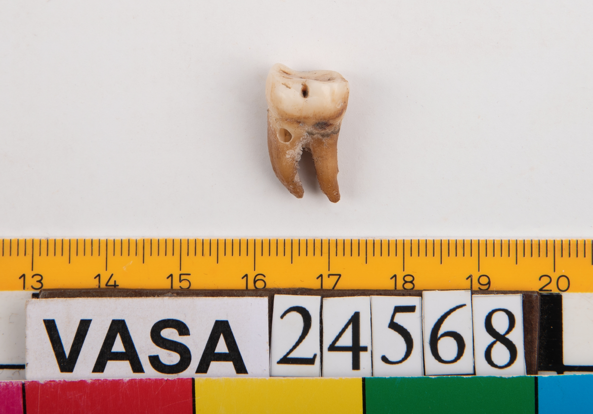 Tredje molaren från vänster sida i underkäken.
Molar 3 sinister, mandibula.