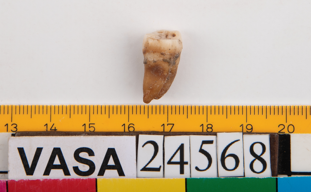 Tredje molaren från vänster sida i underkäken.
Molar 3 sinister, mandibula.