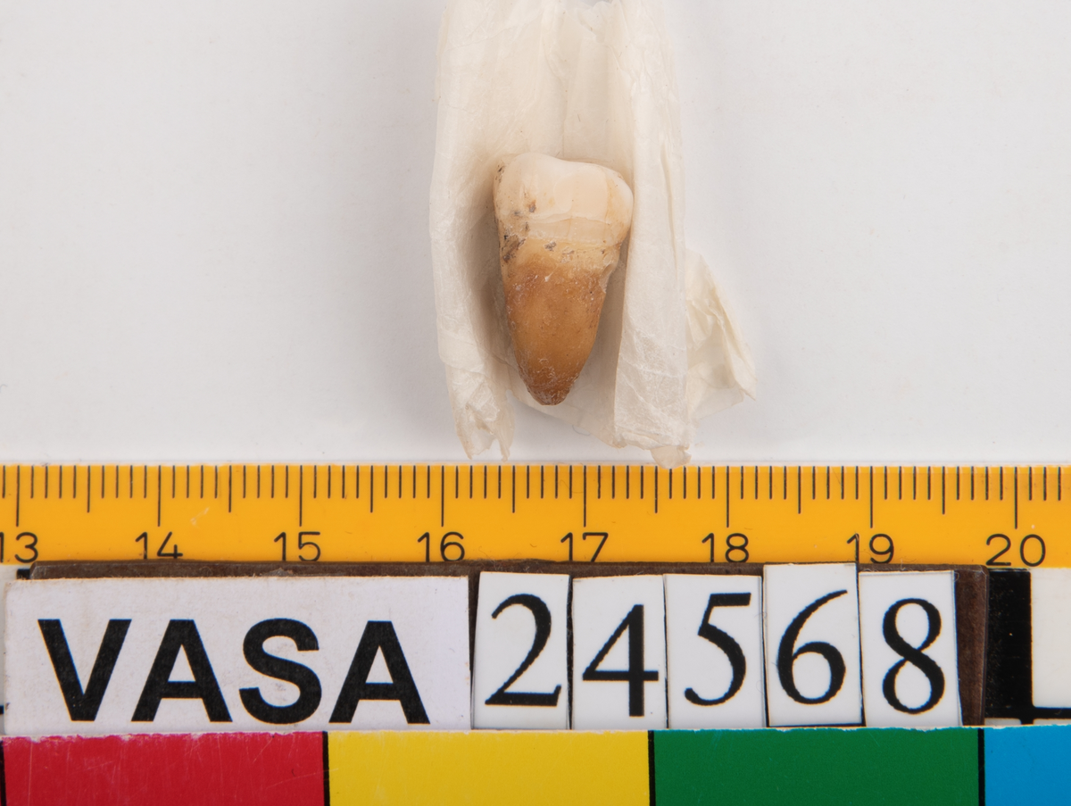 Tredje molaren från vänster sida i underkäken.
Molar 3 sinister, mandibula.
