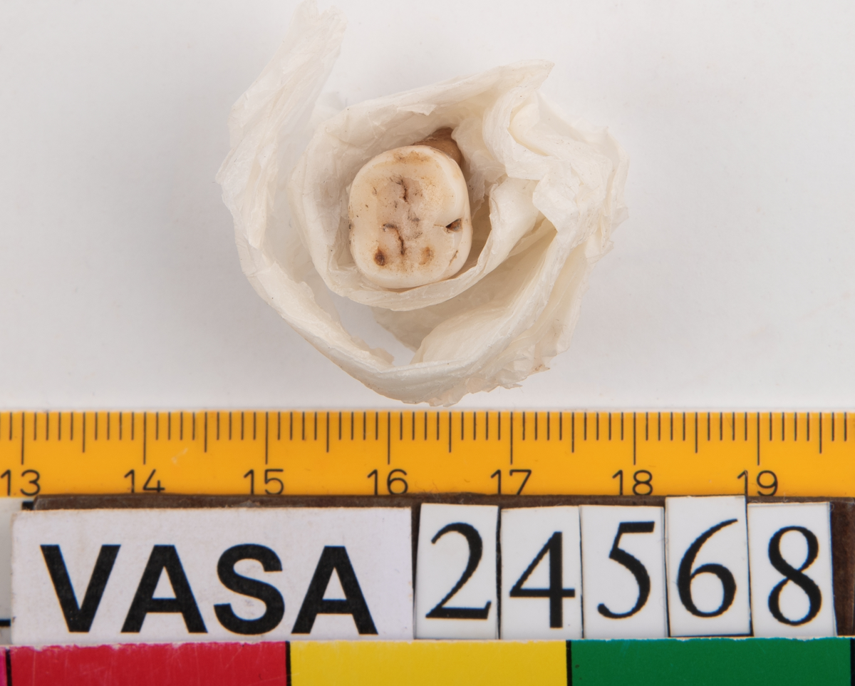Tredje molaren från vänster sida i underkäken.
Molar 3 sinister, mandibula.