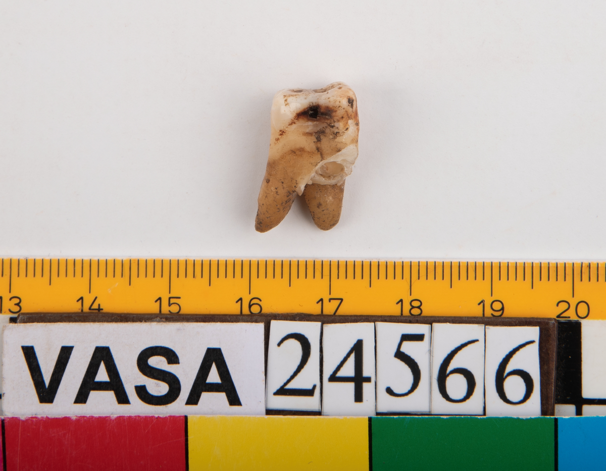 Första molaren från höger sida av överkäken.
Molar 1 dexter, maxilla.
En av tandens rötter sitter kvar i käken.