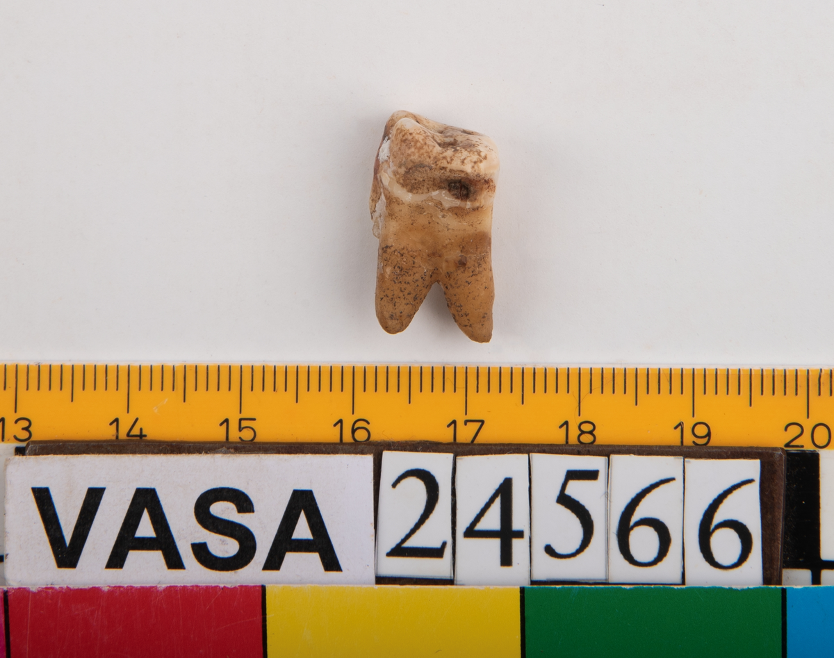 Första molaren från höger sida av överkäken.
Molar 1 dexter, maxilla.
En av tandens rötter sitter kvar i käken.