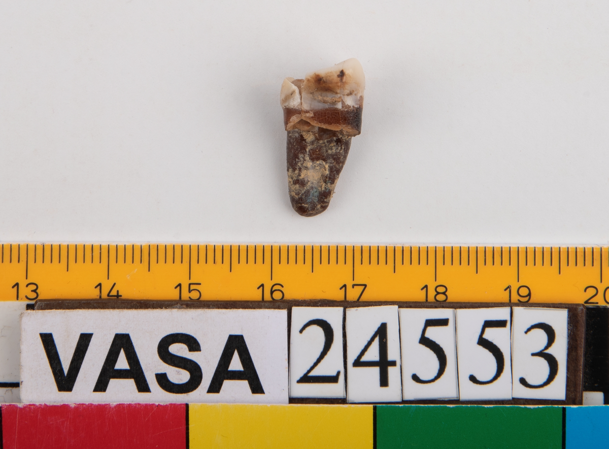 Andra molaren på höger sida i underkäken.
Tandens ena rot sitter kvar i käken.
Molar 2, dexter, mandibula.