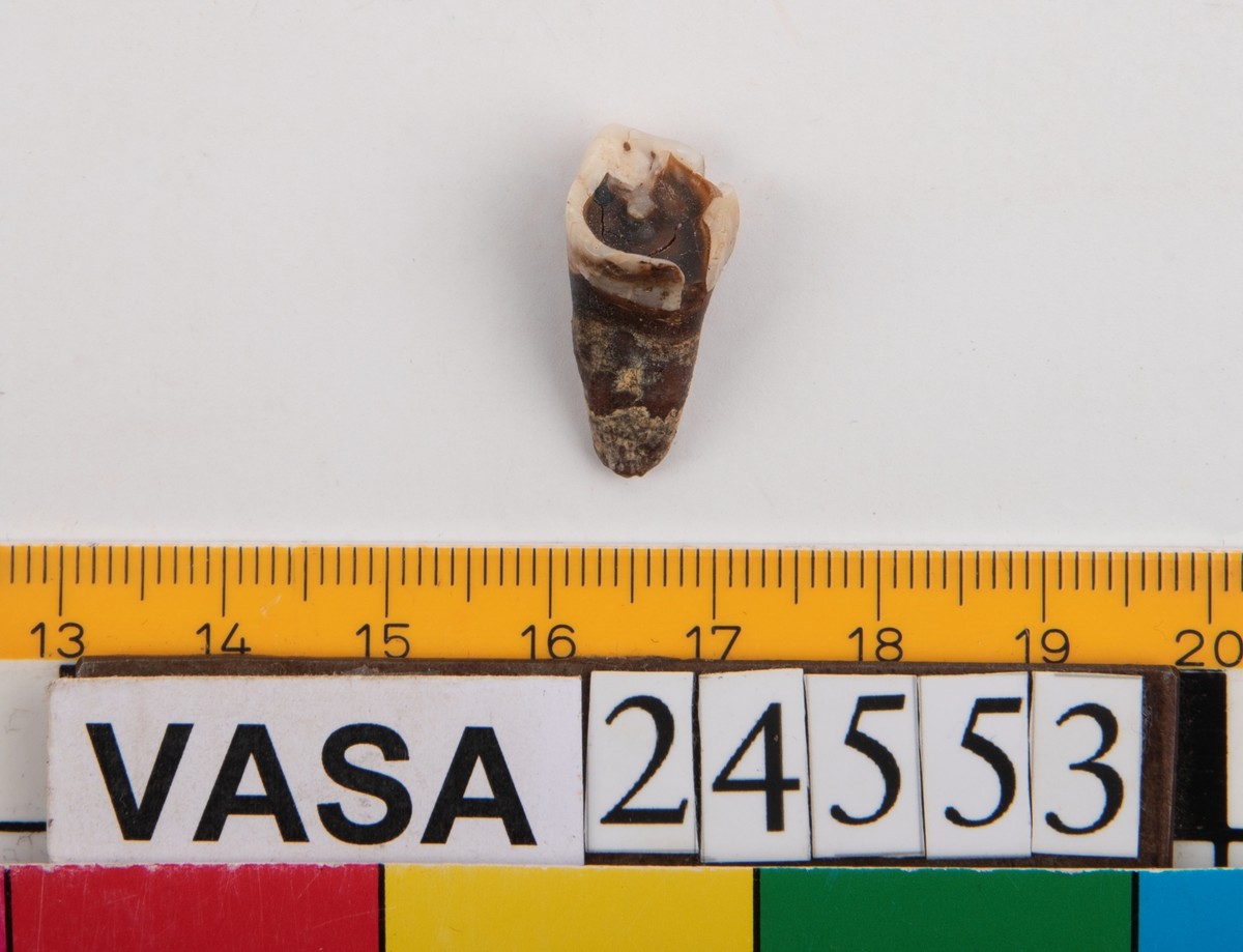 Andra molaren på höger sida i underkäken.
Tandens ena rot sitter kvar i käken.
Molar 2, dexter, mandibula.