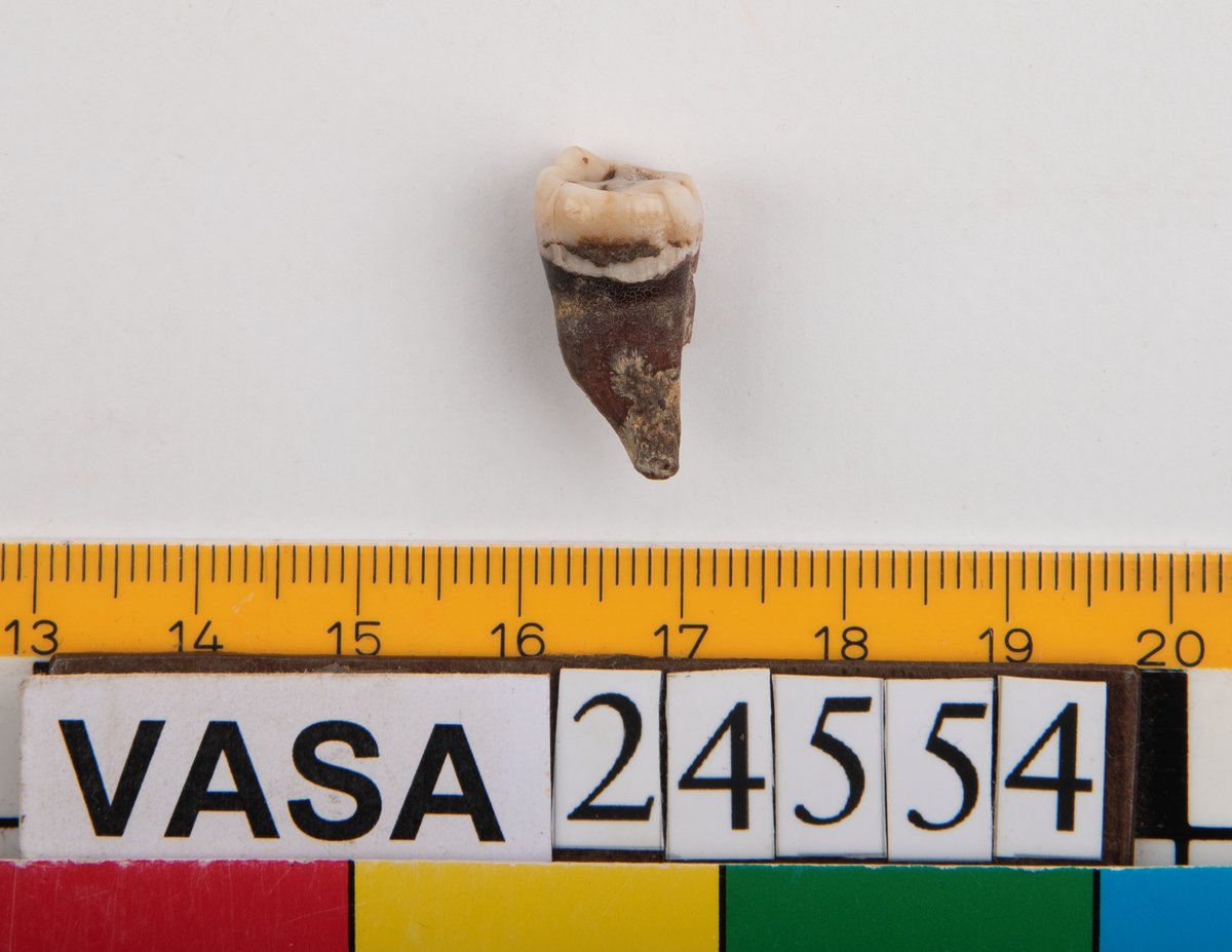 Visdomstanden (tredje molaren) på höger sida i underkäken.
Tandens ena rot sitter kvar i käken.
Molar 3, dexter, mandibula.