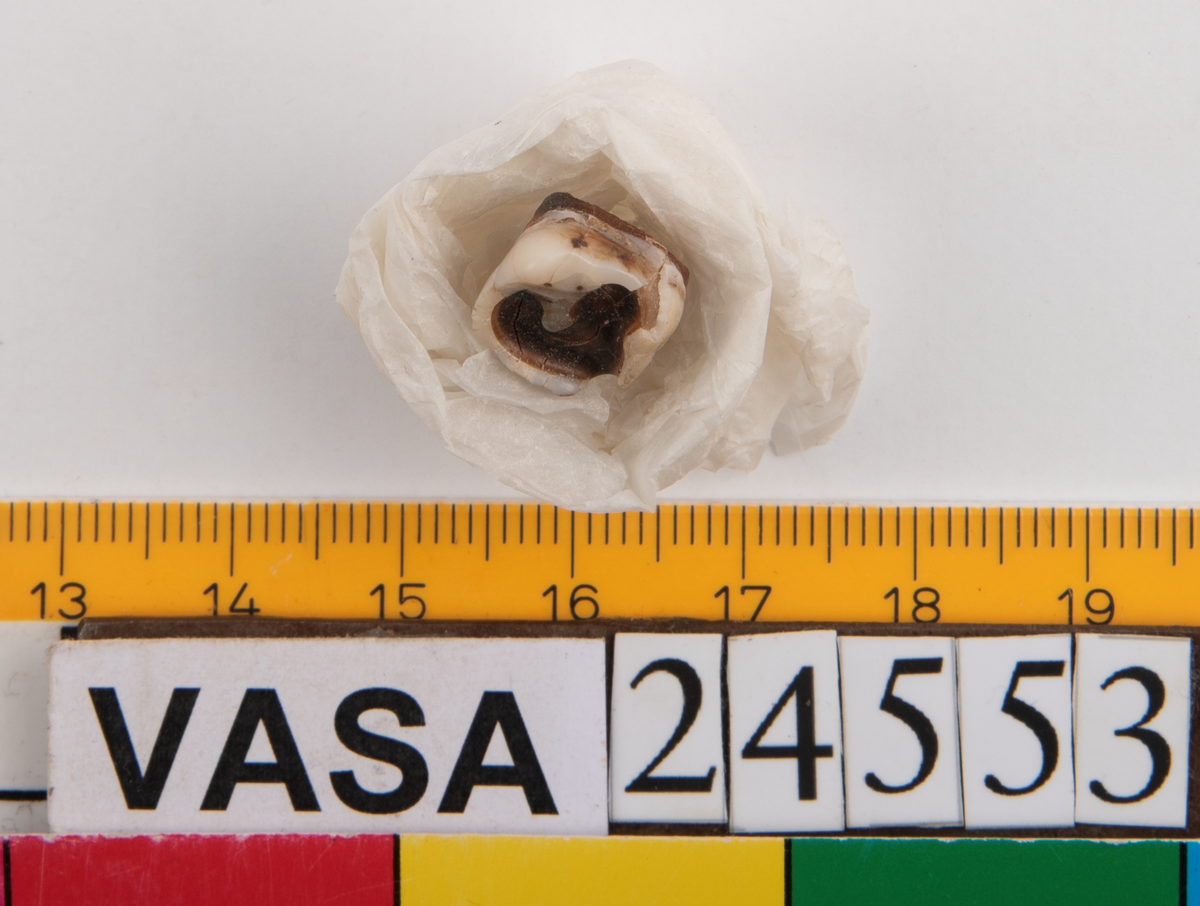 Andra molaren på höger sida i underkäken.
Tandens ena rot sitter kvar i käken.
Molar 2, dexter, mandibula.