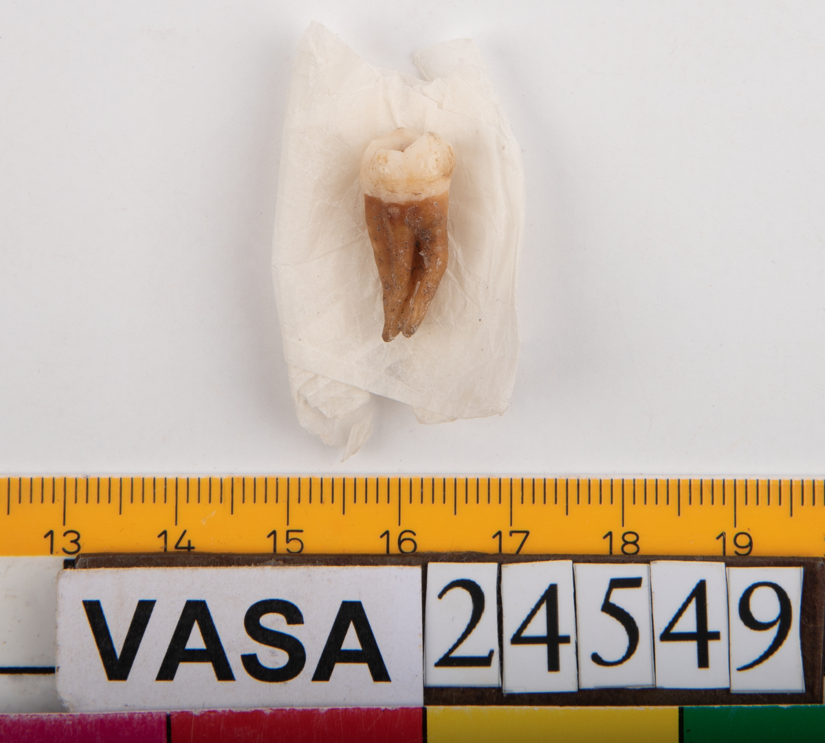 Vänster visdomstand (tredje molaren) från överkäken.
Molar 3 sinister, maxilla.