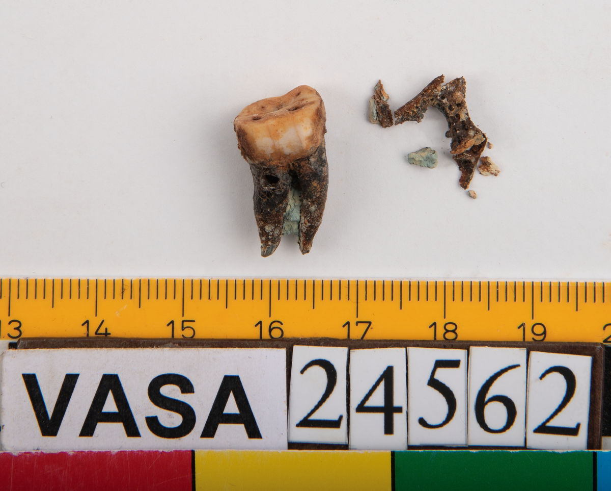 Andra molaren från höger sida i underkäken.
Molar 2 dexter, mandibula.
En liten del av käkbenet medföljer tanden.
