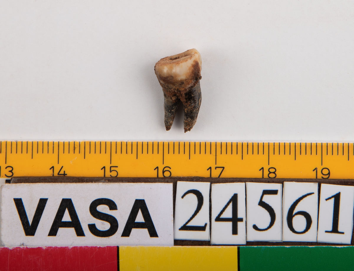 Tredje molaren från höger sida i underkäken.
Molar 3 dexter, mandibula.