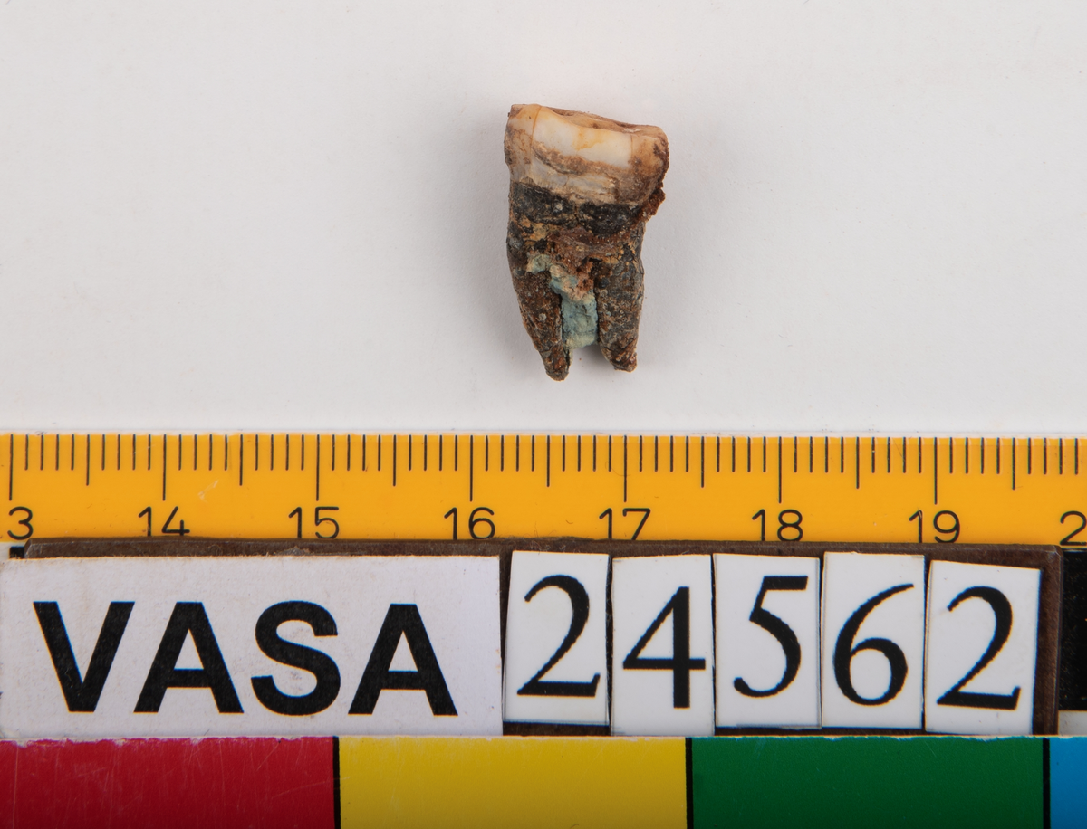 Andra molaren från höger sida i underkäken.
Molar 2 dexter, mandibula.
En liten del av käkbenet medföljer tanden.