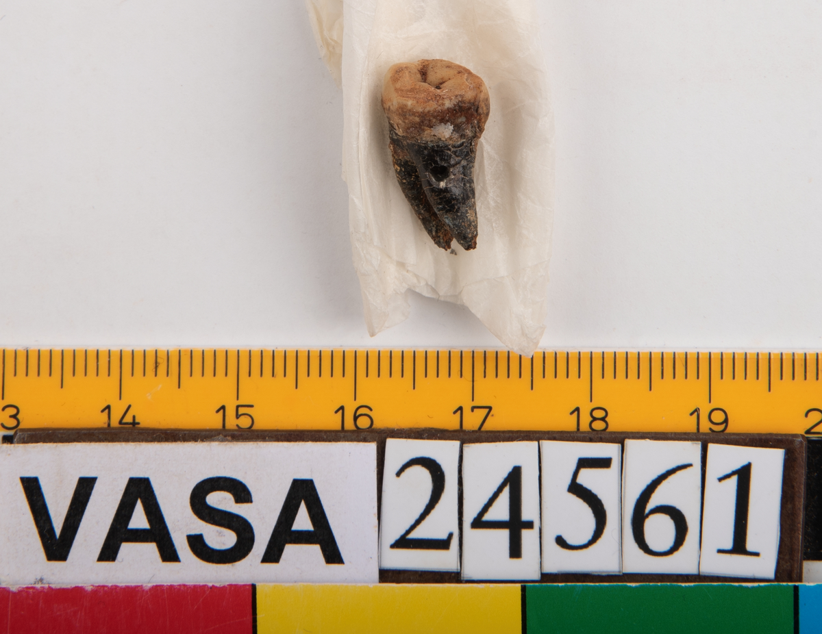 Tredje molaren från höger sida i underkäken.
Molar 3 dexter, mandibula.
