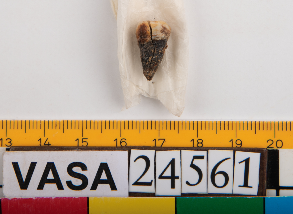 Tredje molaren från höger sida i underkäken.
Molar 3 dexter, mandibula.