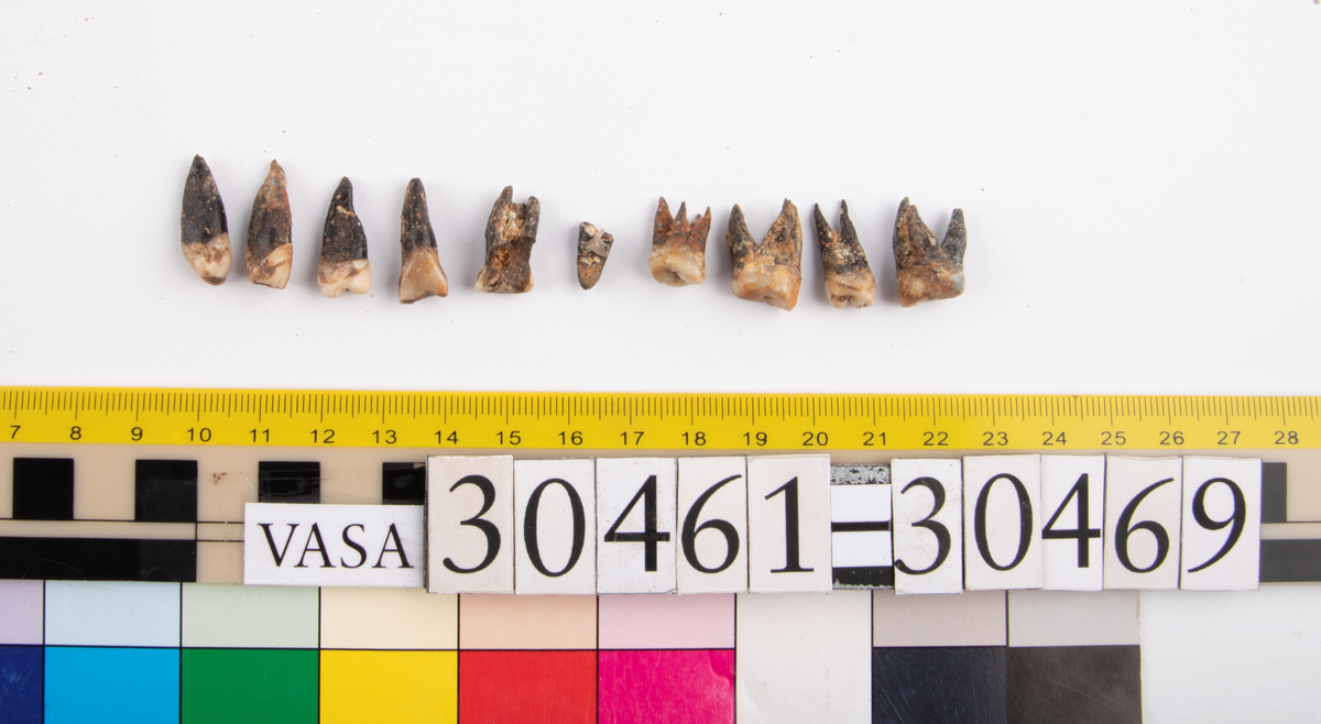 Tand.
Dentes.