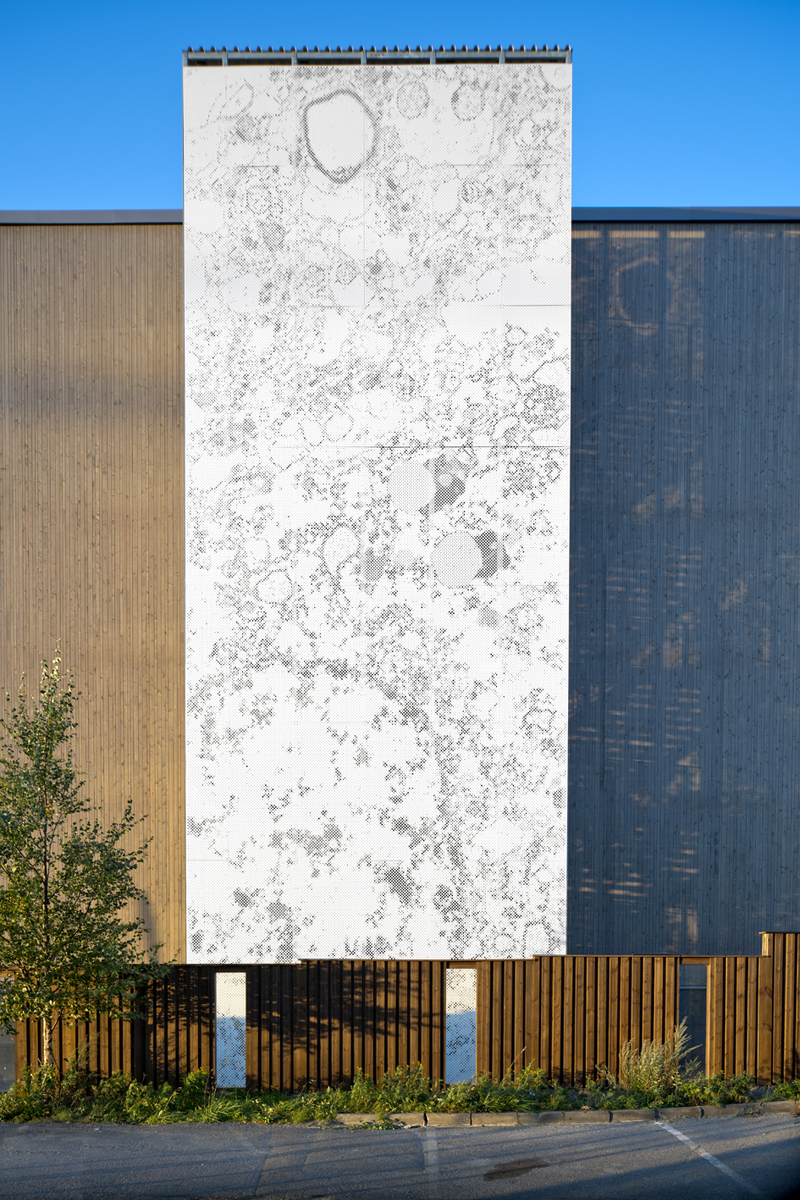 Elektronmikroskopi av menneskehjerne, nucleus accumbens.