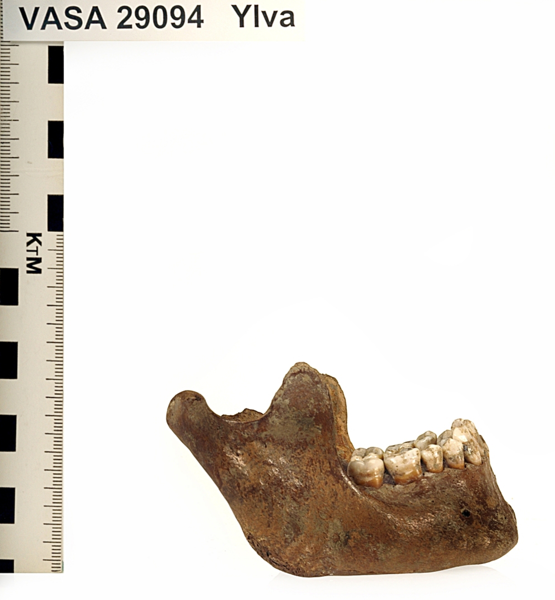 Underkäke med 14 tänder. I gott skick.
Mandibula.