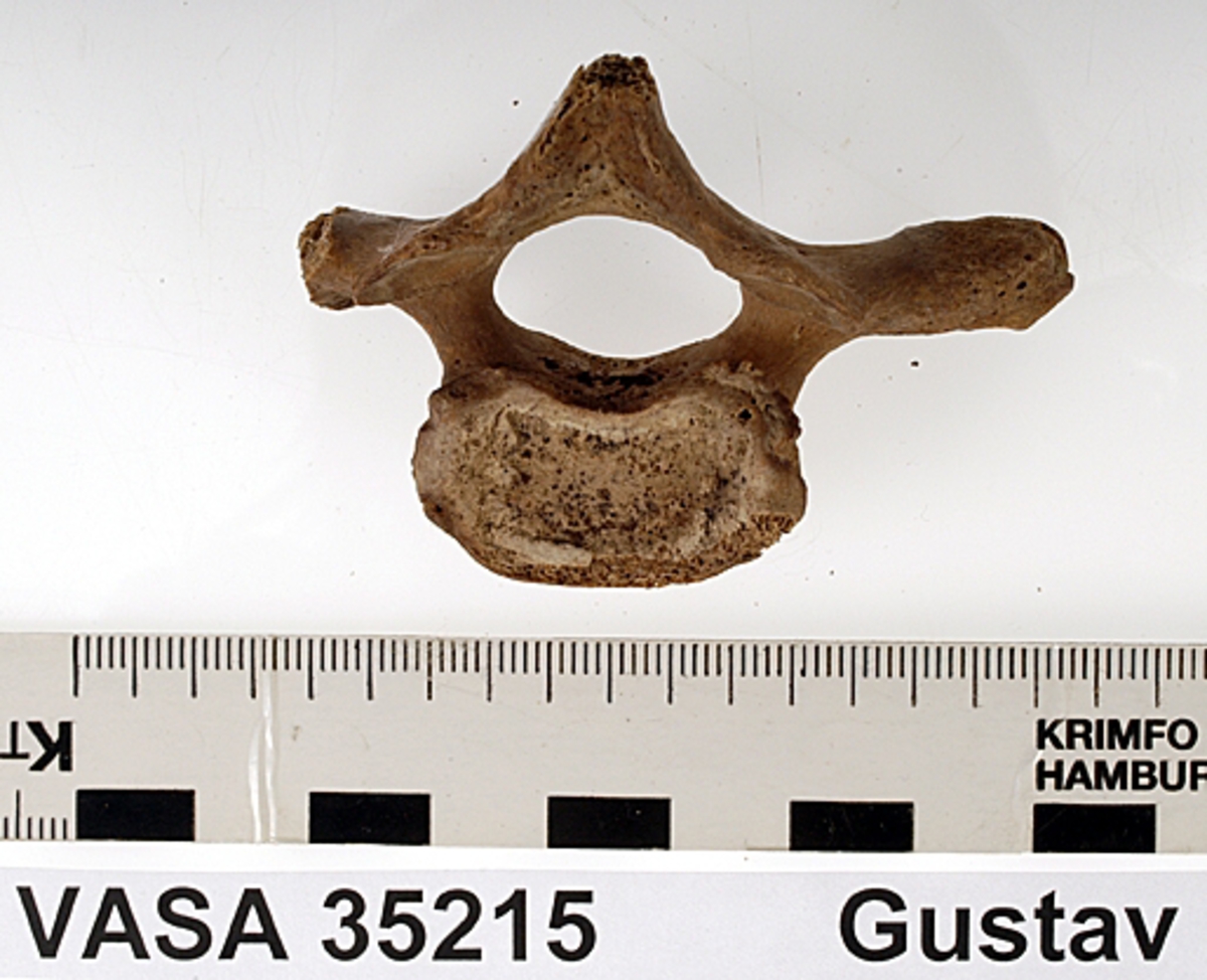 Bröstkota nr 1. I gott skick.
Vertebra Thoracicae no 1.