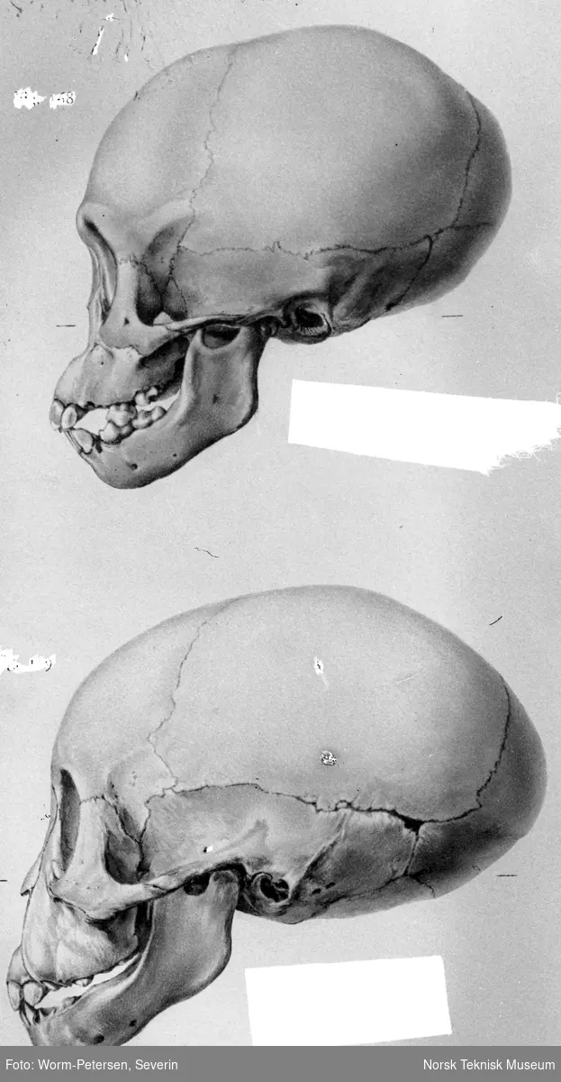 Røntgenbilde av en hodeskalle